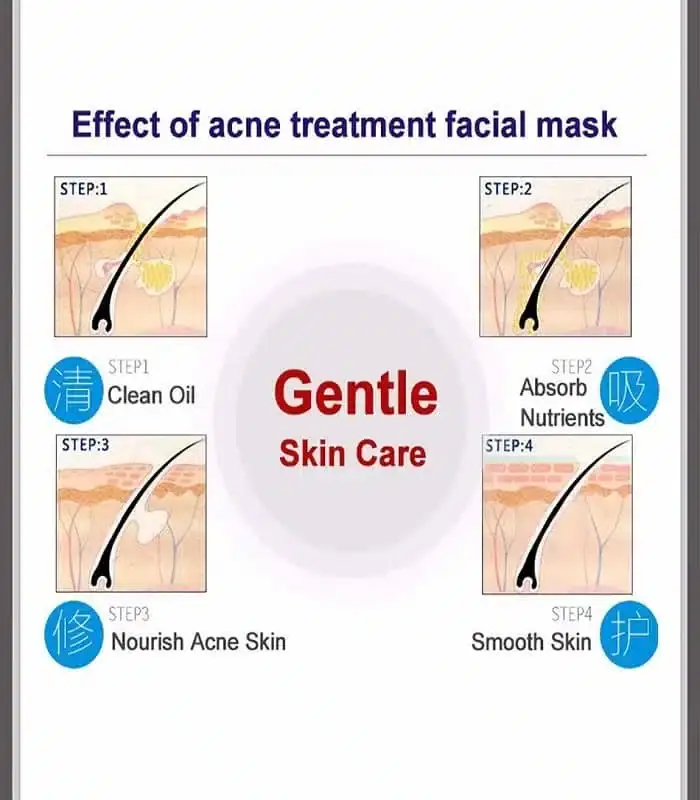 Person applying white Bioaqua Pure Skin Acne Rejuvenation facial sheet mask to skin. - thumbnail