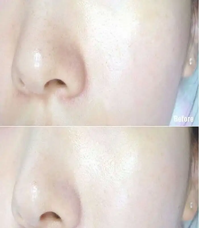 Multiple Dr. Jart+ V7 Toning Light cream dots applied on hand, showing coverage. - thumbnail