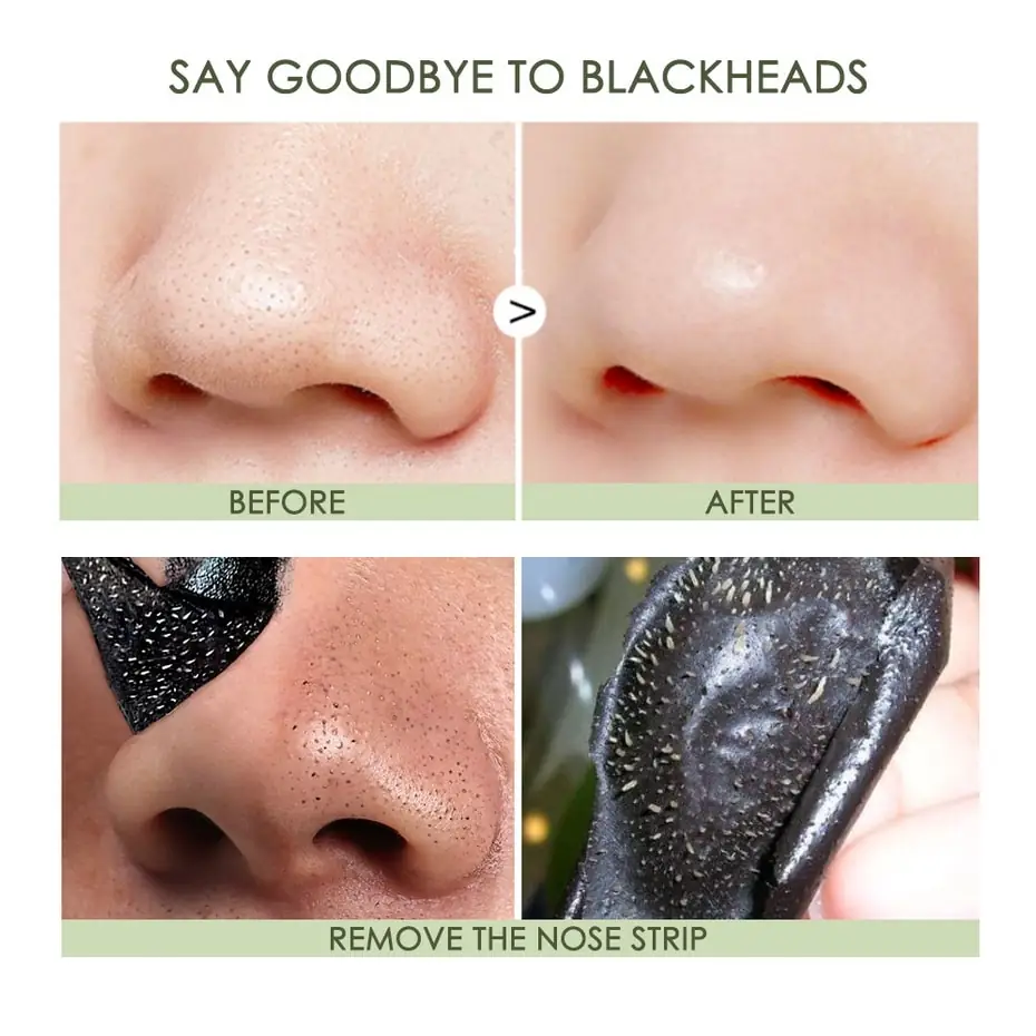 Focallure Blackhead Remover Nose Strip applied to a clean nose for pore cleansing. - thumbnail