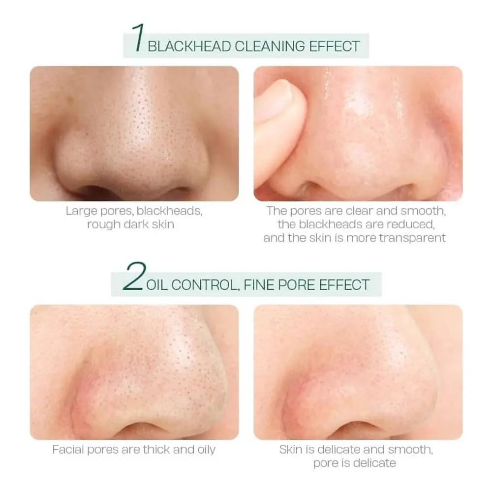 LAIKOU Tea Tree Mud Mask 5gm -5pcs - thumbnail