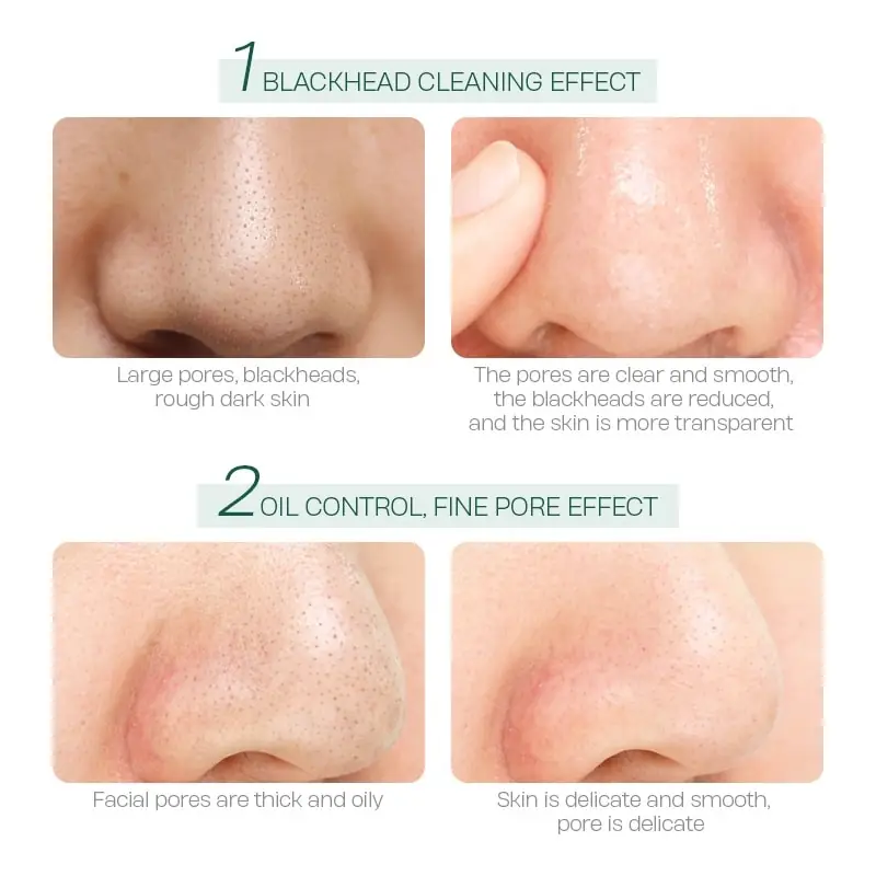 Green Laikou Tea Tree Mud Mask applied on a finger, showcasing its smooth, thick texture. - thumbnail