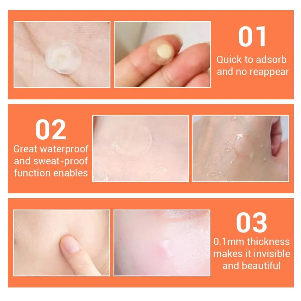 Lanbena Acne Pimple Patch box and open white container displaying translucent patches. - thumbnail
