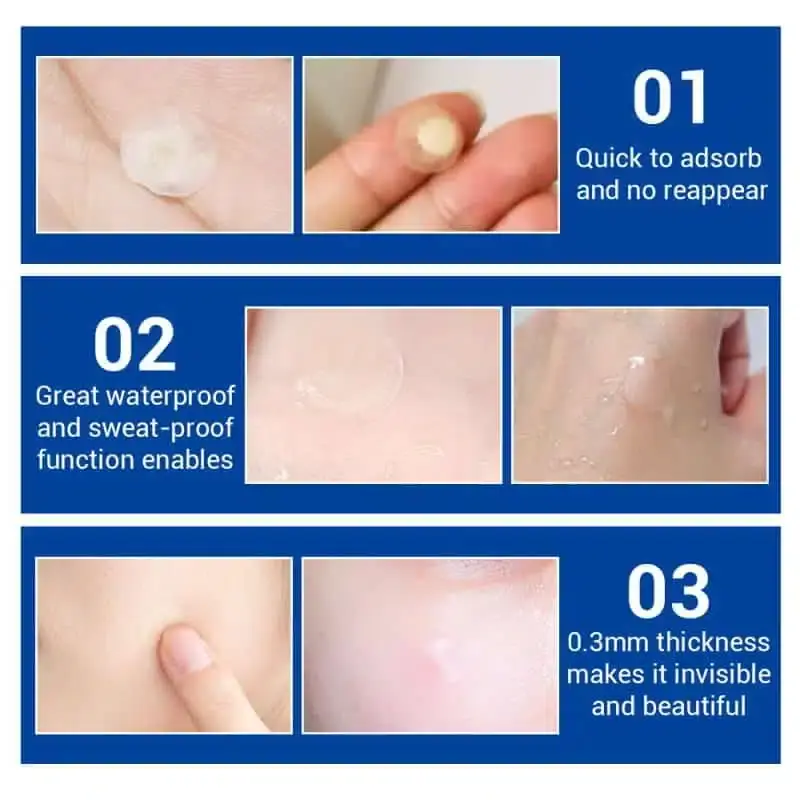 Lanbena clear hydrocolloid pimple patches in various sizes on a transparent protective sheet. - thumbnail