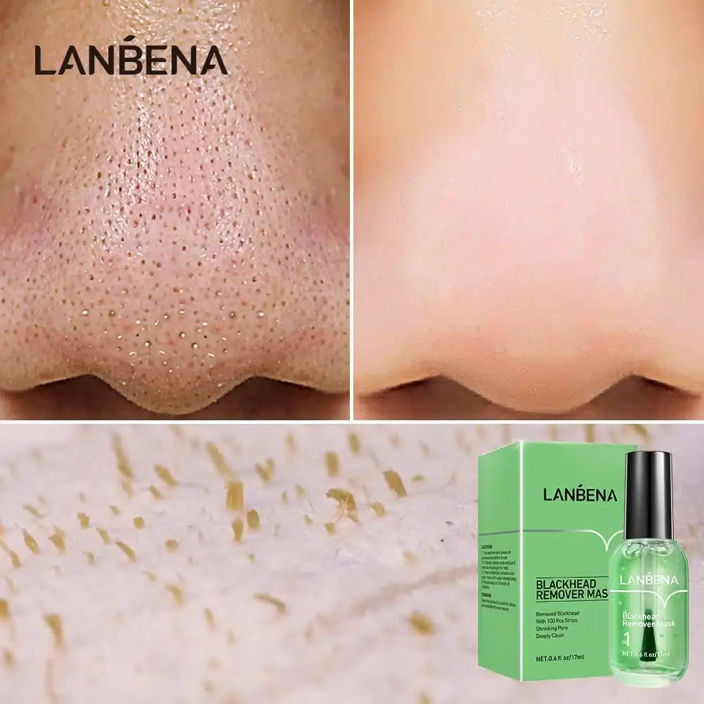 Lanbena Blackhead Remover Mask bottle displayed next to its white and gold packaging box. - thumbnail