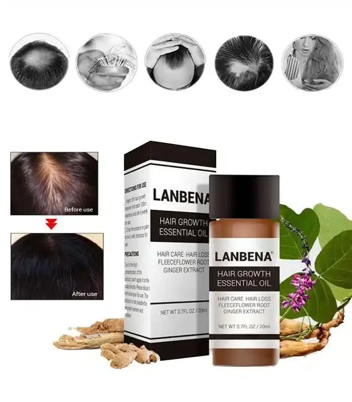 Lanbena Hair Growth Essential Oil bottle partially visible inside its distinctive yellow open packaging box. - thumbnail