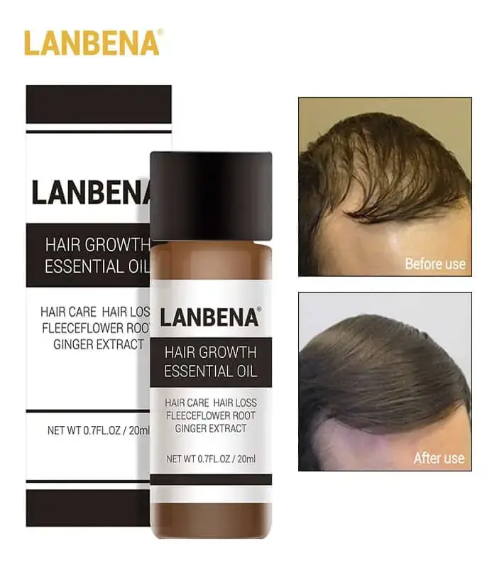 Detailed close-up showing the Lanbena Hair Growth Essential Oil yellow outer packaging box design. - thumbnail