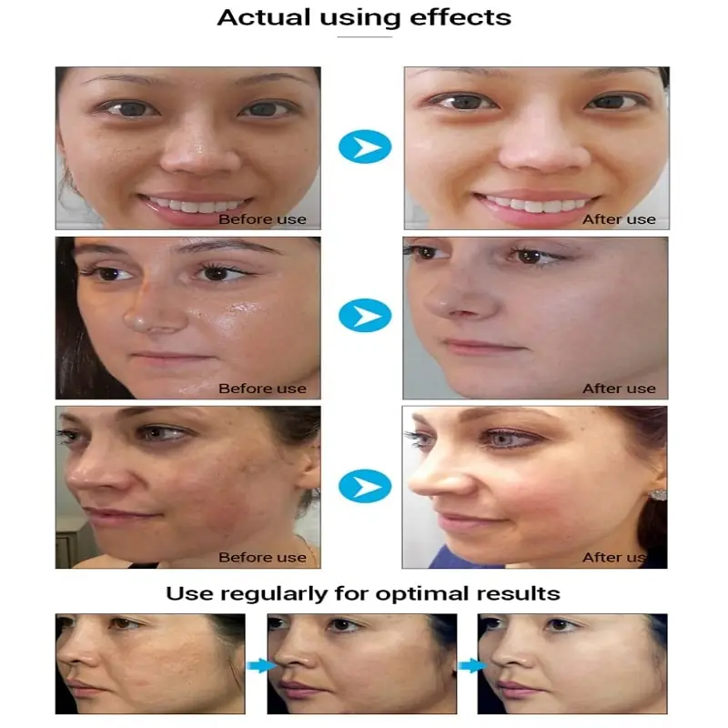 Close-up of a wet, translucent Lanbena Hyaluronic Acid Soap bar with delicate lather. - thumbnail