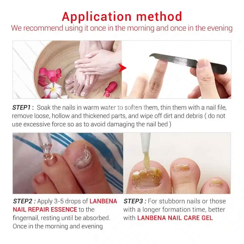 Close-up of the Lanbena Nail Care Gel's precise needle applicator tip with green cap removed. - thumbnail