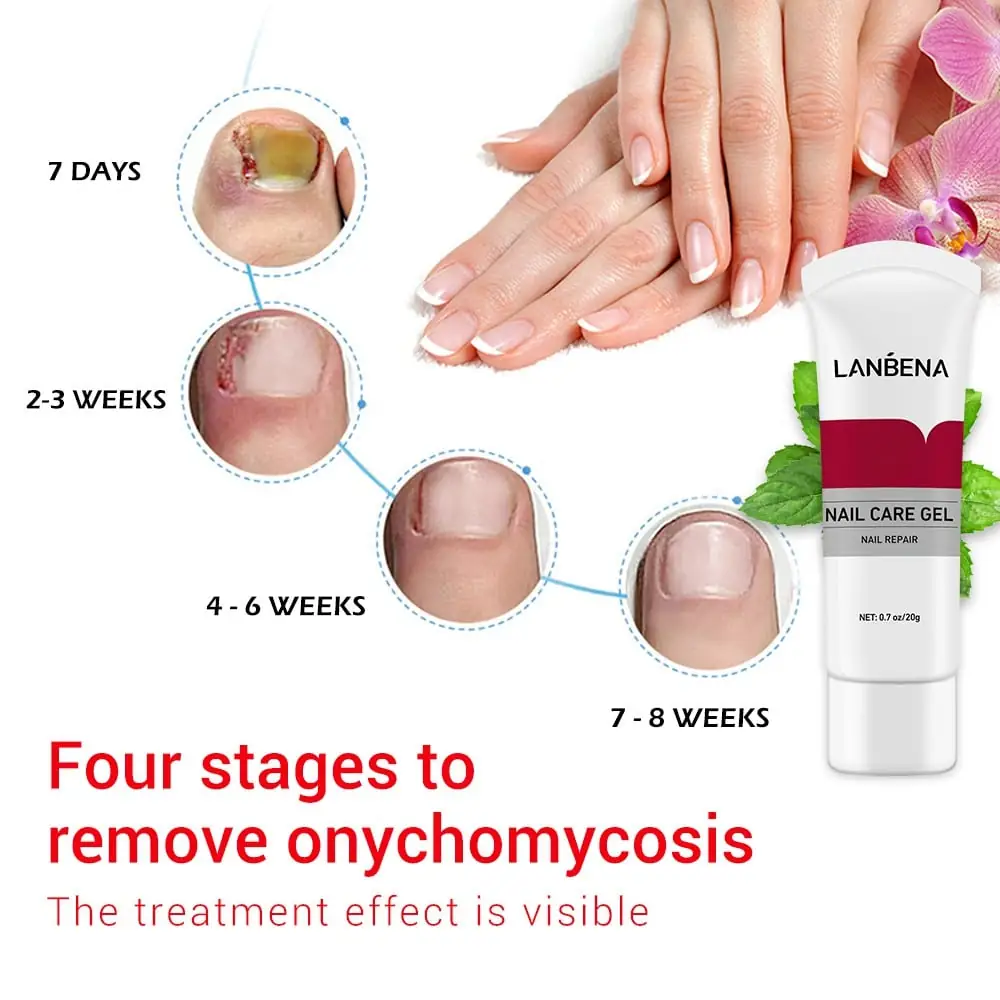 Hand applying Lanbena Nail Care Gel directly onto a fingernail for targeted treatment. - thumbnail