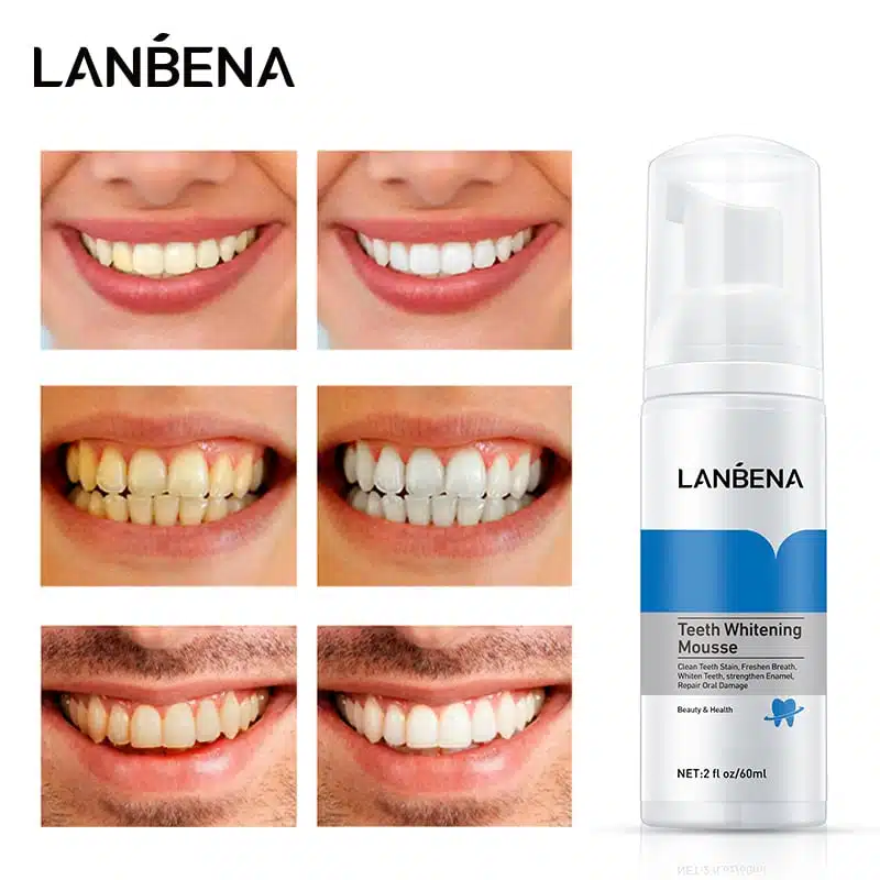 Lanbena Teeth Whitening Mousse 60ml pump bottle displayed at a slight angle on white. - thumbnail