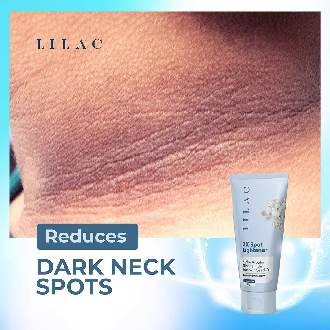 LILAC 3X Spot Lightener Cream 50g jar opened, showcasing its smooth white cream texture. - thumbnail