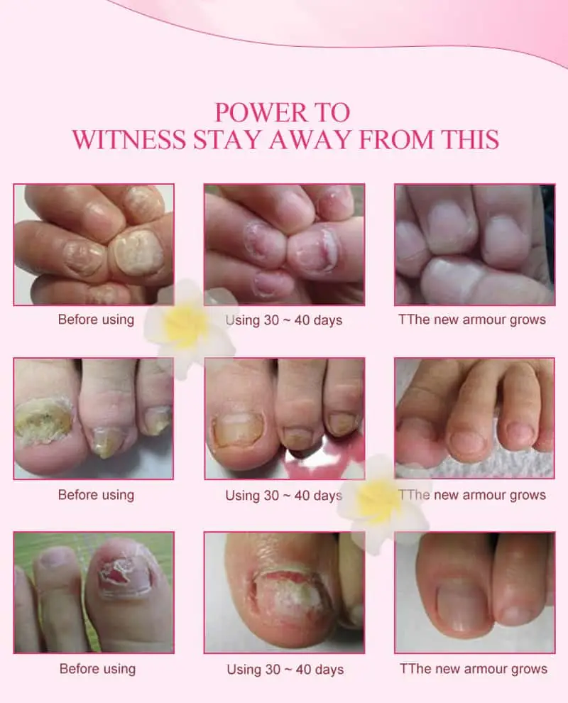 Swatch of white Meiyanqiong The Herb Nail Repair Cream next to its open tube. - thumbnail
