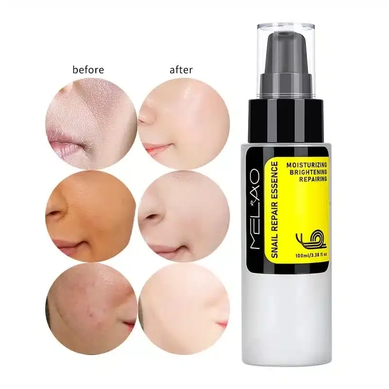 Melao Snail Repair Essence 100ml clear glass bottle held in a hand, showing product scale. - thumbnail