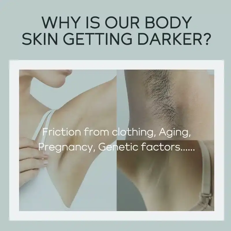 Hand gently squeezing white Quiyum Underarm Beauty Cream from tube onto fingertips, showing texture. - thumbnail