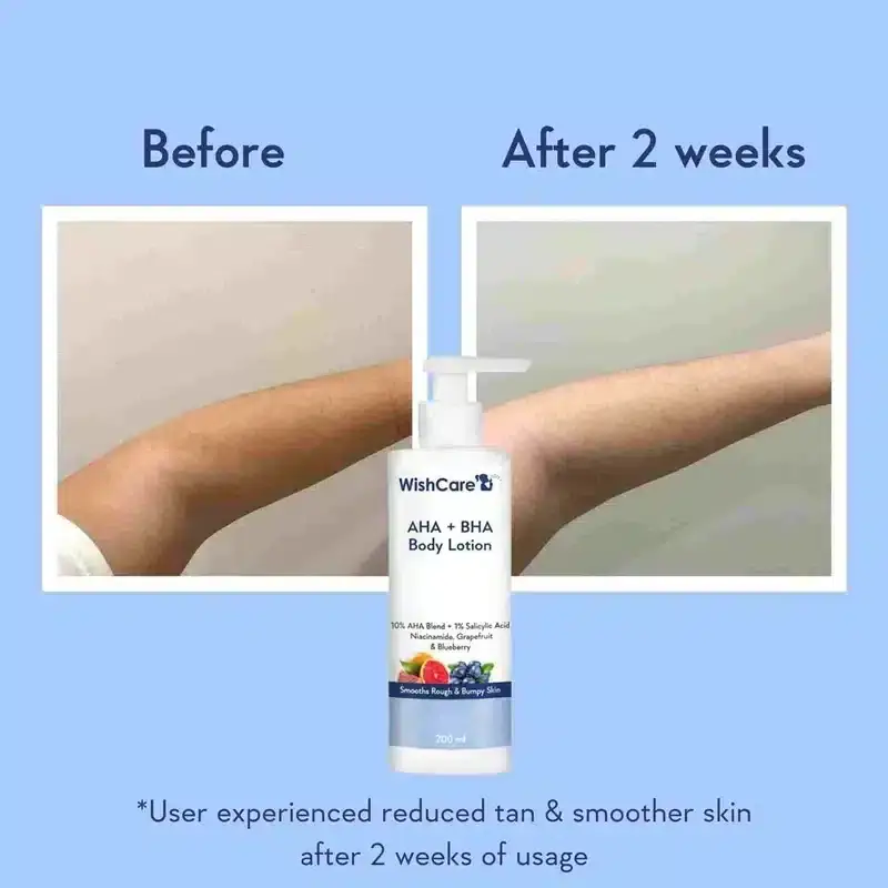 Back of WishCare AHA + BHA Body Lotion 200ml bottle displaying ingredients and details. - thumbnail